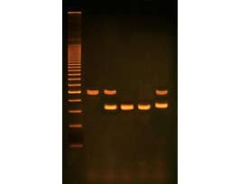 PCR BASED ALU-HUMAN DNA TYPING